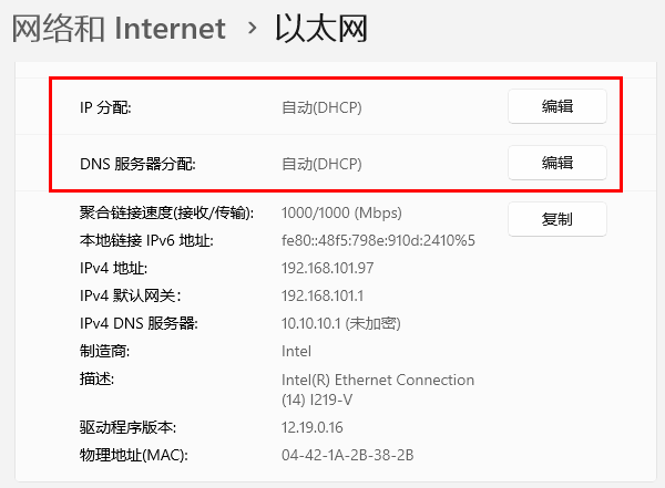 电脑自动获取IP地址 电脑自动获取IP地址